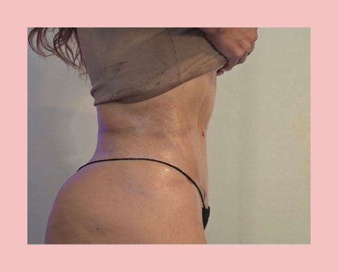Post-Op Lymphatic Drainage Maintenance Massage with Sauna Wrap after